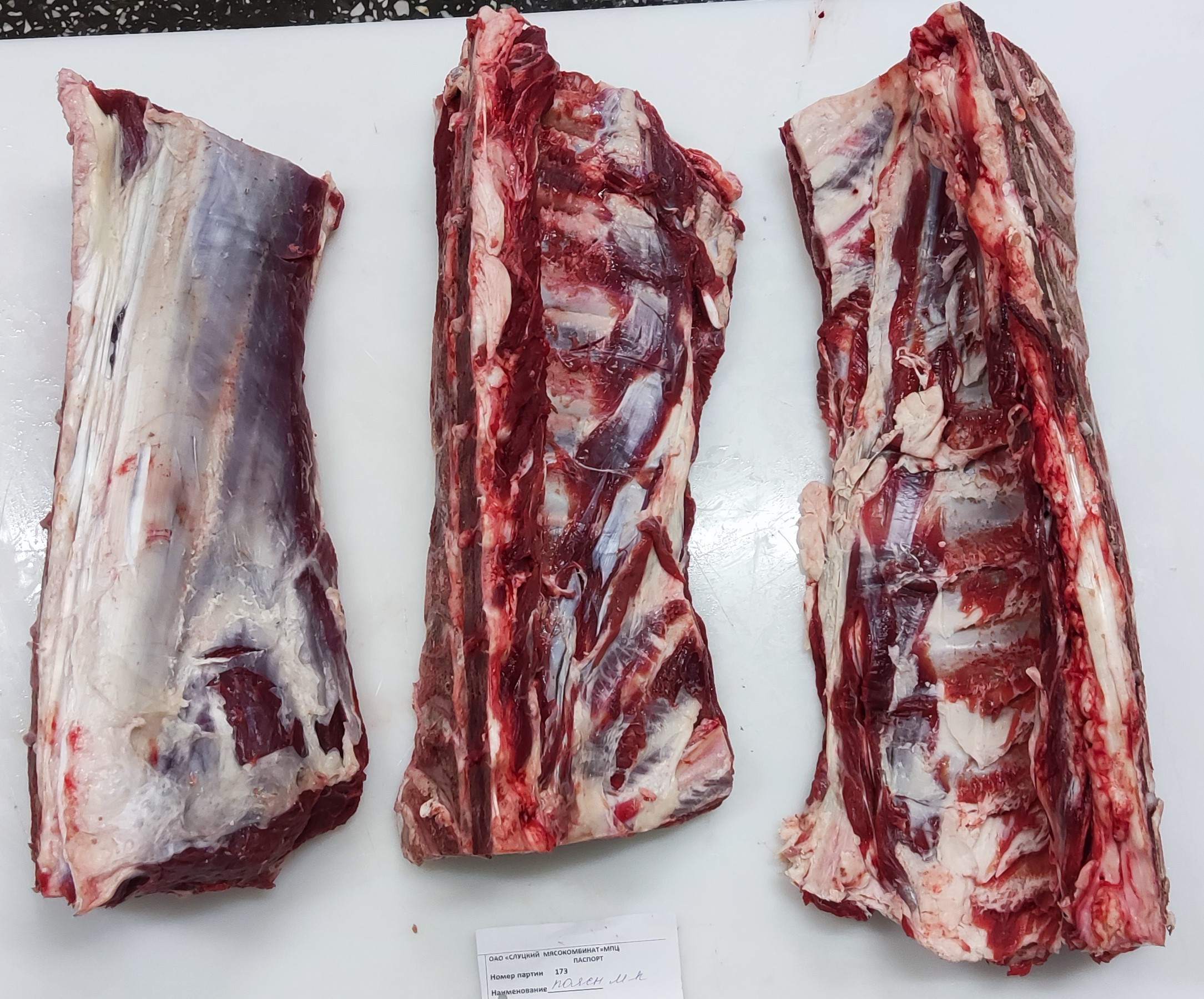 5. Поясничная часть спинно-поясничного столба.jpg